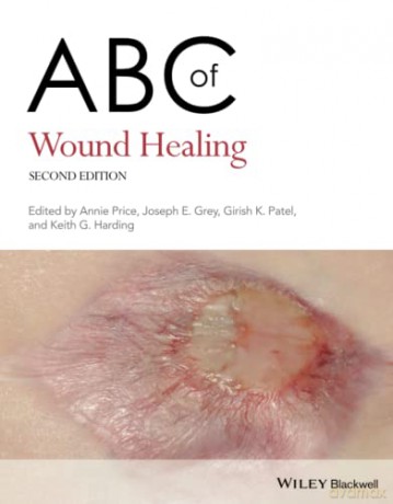 ABC of Wound Healing (ABC Series) [KSIĄŻKA]