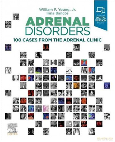 Adrenal Disorders: 100 Cases from the Adrenal Clinic - William F. Young [KSIĄŻKA]