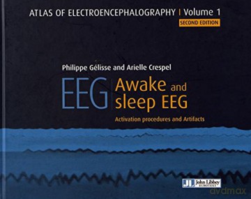Atlas of Electroencephalography: Awake and sleep EEG - Angelad. Sims [KSIĄŻKA]