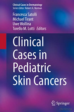 Clinical Cases in Pediatric Skin Cancers (Clinical Cases in Dermatology) - Francesca Satolli [KSIĄŻKA]