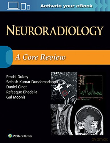 Neuroradiology: A Core Review [KSIĄŻKA]