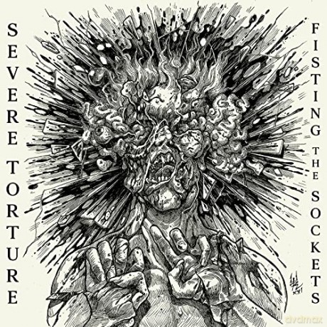 Severe Torture: Fisting The Sockets [CD]