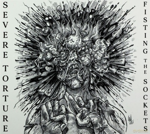 Severe Torture: Fisting The Sockets [CD]