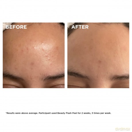 Clarins ( Beauty Flash Peel) 50 ml