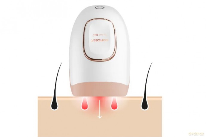 Depilator Concept il3000