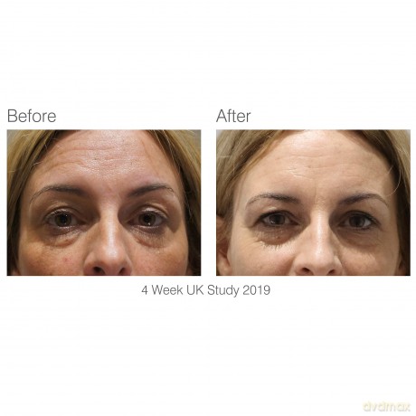 Rio-Beauty Facelite Evolution facial light therapy