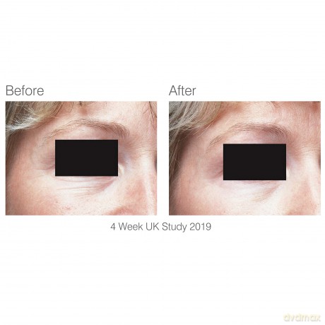 Rio-Beauty Facelite Evolution facial light therapy