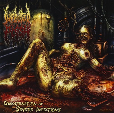 Infected Flesh: Concatenation of Severe.. [CD]