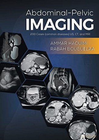 Abdominal-Pelvic Imaging: 200 Cases (Common Diseases): US, CT and MRI - Rabah Bouguelaa [KSIĄŻKA]