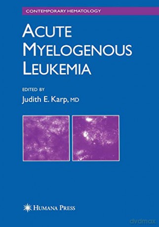 Acute Myelogenous Leukemia (Contemporary Hematology) - Judith E. Karp [KSIĄŻKA]
