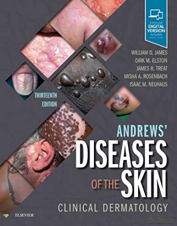 Andrews' Diseases of the Skin: Clinical Dermatology, 13e - William D. James MD [KSIĄŻKA]
