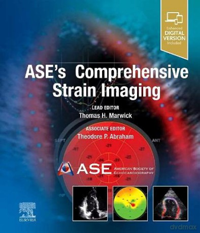 ASE's Comprehensive Strain Imaging - Thomas H. Marwick MBBS PhD MPH [KSIĄŻKA]