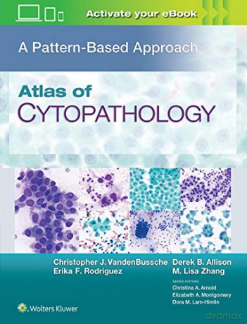 Atlas of Cytopathology: A Pattern Based Approach - M. Lisa Zhang MD [KSIĄŻKA]