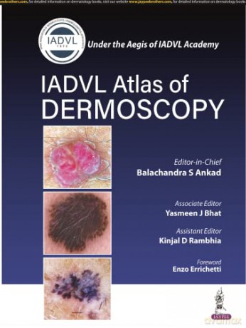 Atlas of Dermoscopy - Kinjal D Rambhia [KSIĄŻKA]
