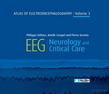 Atlas of Electroencephalography Volume 3: EEG Neurology and Critical Care - Pierre Genton [KSIĄŻKA]