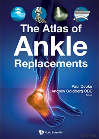 The Atlas of Ankle Replacements - Paul Cooke [KSIĄŻKA]