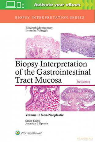 Biopsy Interpretation of the Gastrointestinal Tract Mucosa: Volume 1: Non-Neoplastic (Biopsy Interpretation Series) - Elizabeth A. Montgomery [KSIĄŻKA]