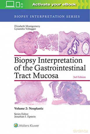 Biopsy Interpretation of the Gastrointestinal Tract Mucosa: Volume 2: Neoplastic: Nonneoplastic (Biopsy Interpretation Series) - Elizabeth A. Montgomery [KSIĄŻKA]