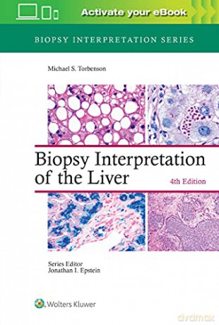 Biopsy Interpretation of the Liver (Biopsy Interpretation Series) - Michael Torbenson MD [KSIĄŻKA]