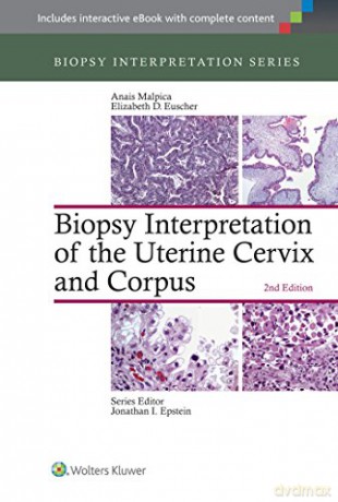 Biopsy Interpretation of the Uterine Cervix and Corpus (Biopsy Interpretation Series) - Anais Malpica [KSIĄŻKA]