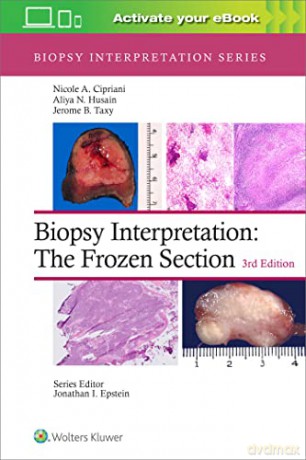 Biopsy Interpretation: The Frozen Section (Biopsy Interpretation Series) - Nicole A. Cipriani MD [KSIĄŻKA]