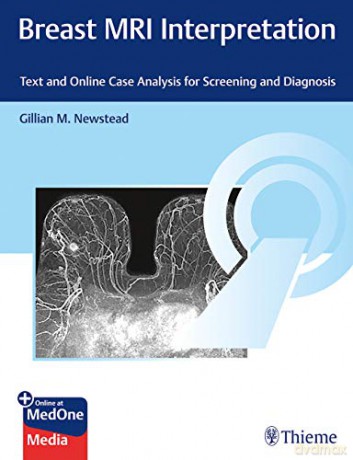Breast MRI Interpretation: Text and Online Case Analysis for Screening and Diagnosis - Gillian M. Newstead [KSIĄŻKA]