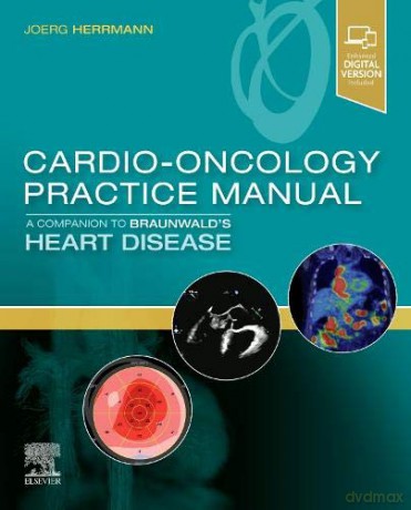Cardio-Oncology Practice Manual: A Companion to Braunwald's Heart Disease - Joerg Herrmann MD [KSIĄŻKA]