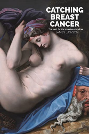 Catching Breast Cancer: The hunt for the breast cancer virus - James Lawson [KSIĄŻKA]