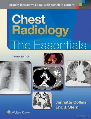Chest Radiology: The Essentials (Essentials Series) - Janette Collins [KSIĄŻKA]
