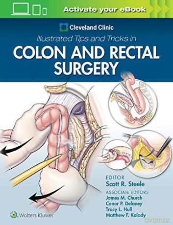 Cleveland Clinic Illustrated Tips and Tricks in Colon and Rectal Surgery - Steele [KSIĄŻKA]