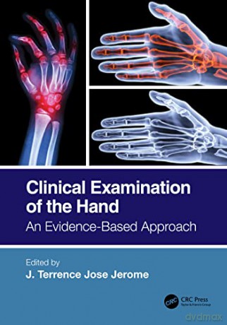 Clinical Examination of the Hand: An Evidence-Based Approach - J. Terrence Jose Jerome [KSIĄŻKA]