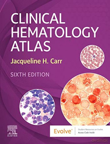 Clinical Hematology Atlas - Jacqueline H. Carr MS MLS [KSIĄŻKA]