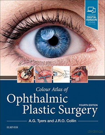 Colour Atlas of Ophthalmic Plastic Surgery, 4e - Anthony G. Tyers FRCS(Eng) FRCS(Ed) FRCOphth [KSIĄŻKA]