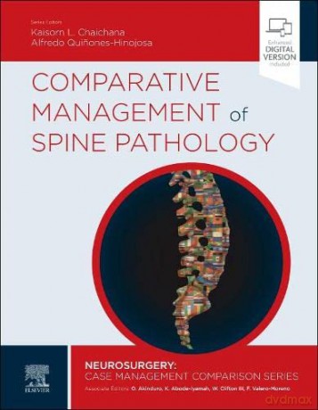 Comparative Management of Spine Pathology (Neurosurgery: Case Management Comparison Series) - Kaisorn Chaichana MD [KSIĄŻKA]
