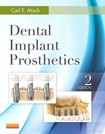 Dental Implant Prosthetics, 2e - Carl E. Misch DDS MDS PhD(HC) [KSIĄŻKA]