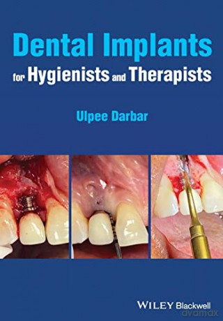 Dental Implants for Hygienists and Therapists - Ulpee R. Darbar [KSIĄŻKA]