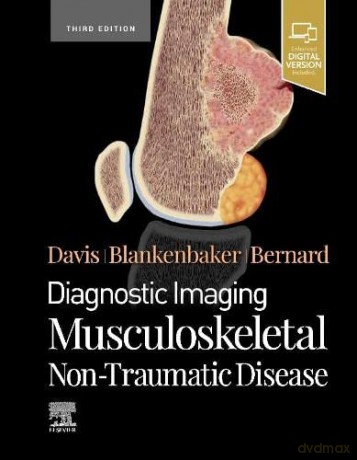 Diagnostic Imaging: Musculoskeletal Non-Traumatic Disease - Stephanie Bernard MD [KSIĄŻKA]