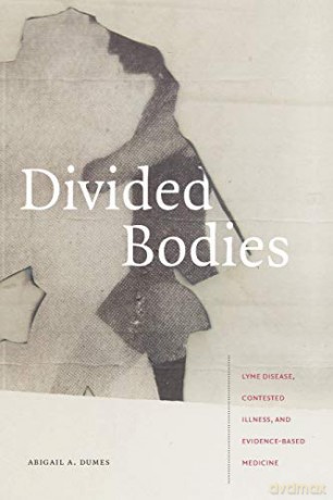 Divided Bodies: Lyme Disease, Contested Illness, and Evidence-Based Medicine (Critical Global Health: Evidence, Efficacy, Ethnography) - Abigail A. Dumes [KSIĄŻKA]