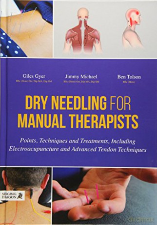 Dry Needling for Manual Therapists: Points, Techniques and Treatments, Including Electroacupuncture and Advanced Tendon Techniques - Jimmy Michael and Ben Tolson Giles Gyer [KSIĄŻKA]
