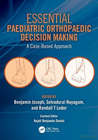 Essential Paediatric Orthopaedic Decision Making: A Case-Based Approach - Benjamin Joseph [KSIĄŻKA]