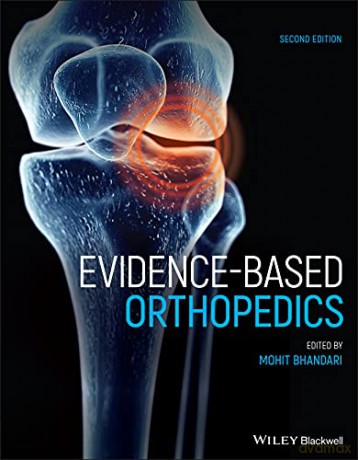 Evidence-Based Orthopedics (Evidence-Based Medicine) - Mohit Bhandari [KSIĄŻKA]