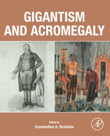 Gigantism and Acromegaly: Genetics, Diagnosis, and Treatment - Constantine A. Stratakis MD D(med)Sci PhD(hon) [KSIĄŻKA]