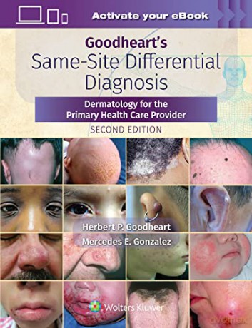 Goodheart's Same-Site Differential Diagnosis: Dermatology for the Primary Health Care Provider - Herbert Goodheart [KSIĄŻKA]