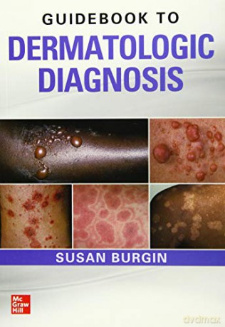 Guidebook to Dermatologic Diagnosis (DERMATOLOGY) - Susan Burgin [KSIĄŻKA]