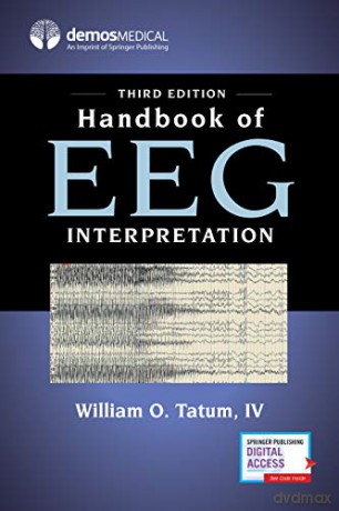 Handbook of EEG Interpretation: A Guide to Policy, Programs, and Services - William O. Tatum [KSIĄŻKA]