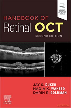 Handbook of Retinal OCT: Optical Coherence Tomography - Jay S. Duker MD [KSIĄŻKA]