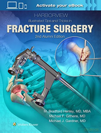 Harborview Illustrated Tips and Tricks in Fracture Surgery - M. Henley [KSIĄŻKA]