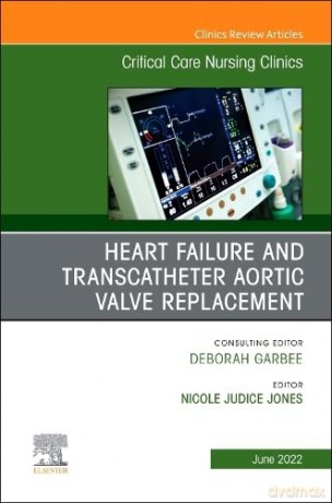 Heart Failure and Transcatheter Aortic Valve Replacement, An Issue of Critical Care Nursing Clinics of North America (Volume 34-2) (The Clinics: Nursing, Volume 34-2) - Nicole Jones [KSIĄŻKA]
