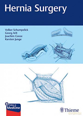 Hernia Surgery - Karsten Junge [KSIĄŻKA]