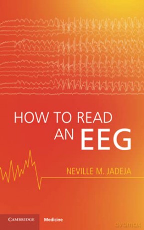 How to Read an EEG - Neville M. Jadeja [KSIĄŻKA]